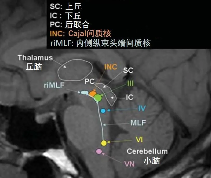 中脑为人体重要的神经核团