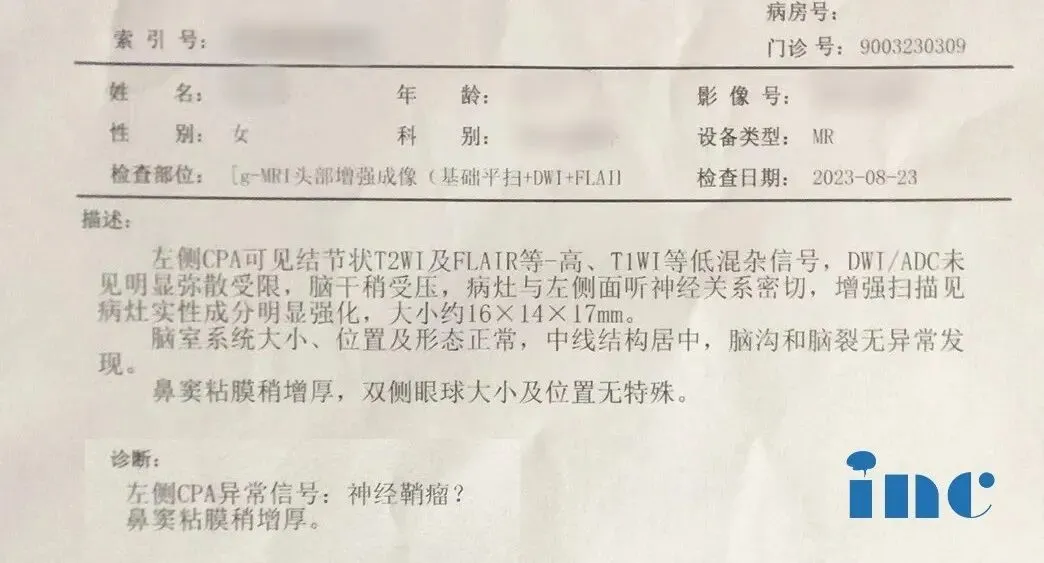 术前检查显示吴女士已经出现轻微的脑干受压,面部和三叉神经受累的迹象(左嘴角刺痛等)以及听力障碍。这个诊断解释了她多年来所有的症状,也让她面临一个艰难的抉择。