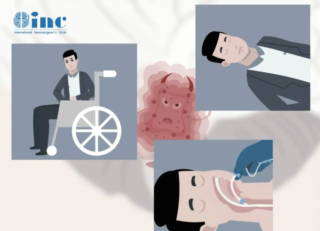 颅内出血是 AVM 患者最主要的症状,比普通脑出血的预后稍好,但仍有 11% 的患者在出血后 1 个月内死亡,40% 会留下严重后遗症(比如偏瘫、失语)。