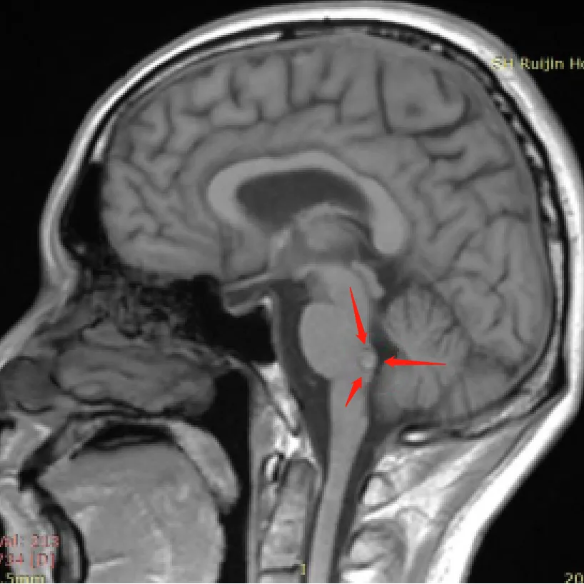 两次保守治疗  一场 “两害相权取其轻” 的博弈