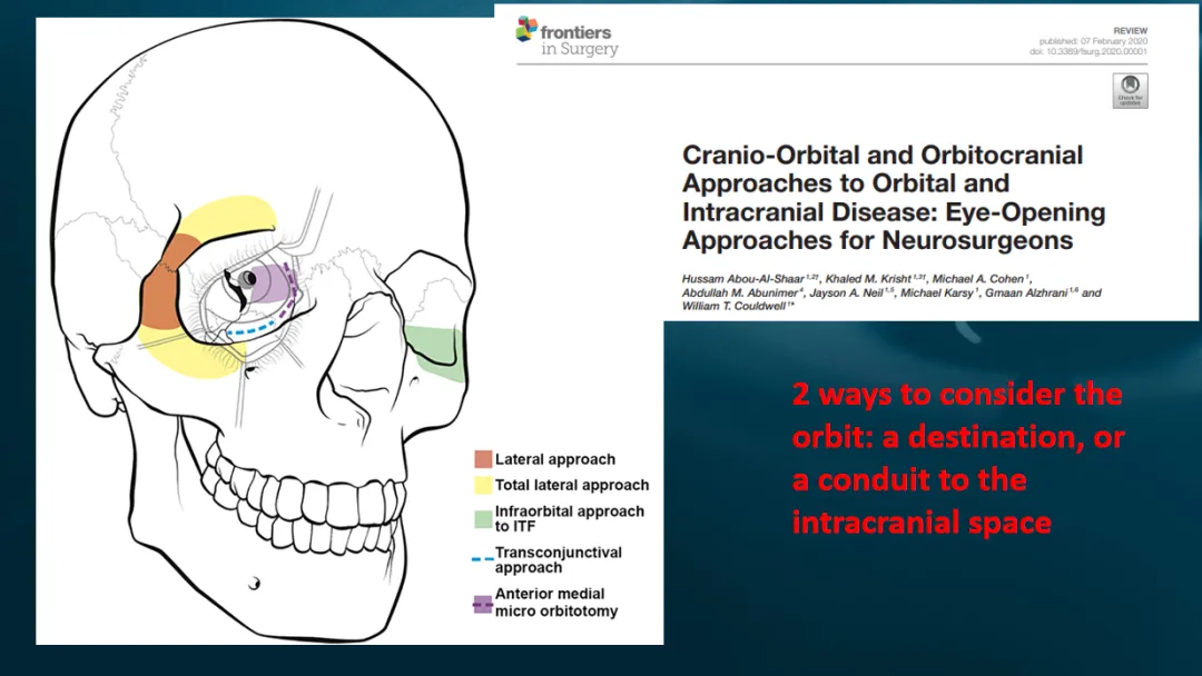 颅底神经外科医生必须熟悉眼眶