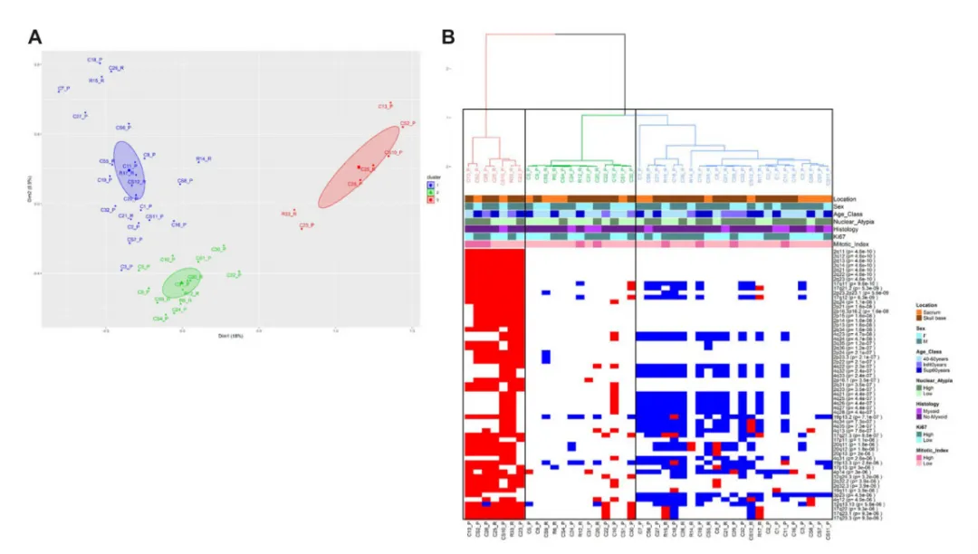 图6. 基于CGH检测321个拷贝数变异(CNV)的脊索瘤患者多重对应分析(MCA)。