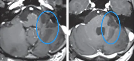 H男士术后MR影像