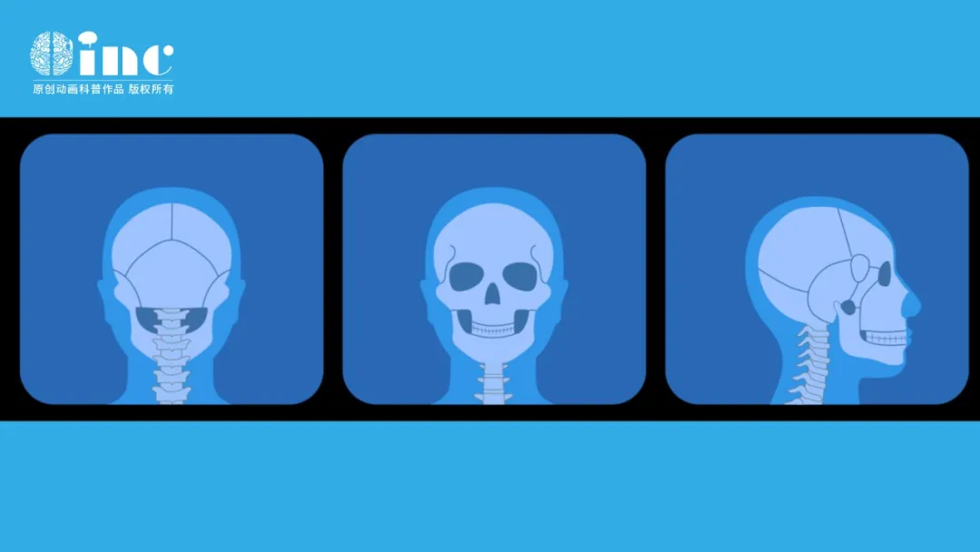 最终的诊断可能依赖于实验室血清或脑脊液肿瘤标志物以及组织学和免疫组化检查