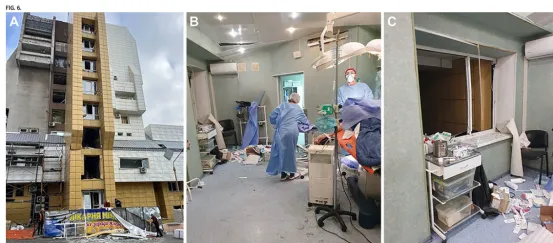 图6：A：2024年10月25日附近遭遇导弹袭击后的梅奇尼科夫医院。B和C：神经外科急诊手术室内，门窗破损，天花板坍塌。手术室内所有物品均覆盖着玻璃碎片。导弹爆炸时，博赫丹·西尔科医生及其手术团队正在为一名急性创伤性硬膜下血肿患者进行开颅手术（B）。