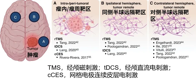 胶质瘤术后生活质量差怎么办？INC国际Berger教授谈介入性神经康复治疗的应用前