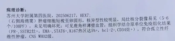 术后病理:孤立性纤维性肿瘤,CNS WHO2级,这是一种基于硬脑膜的成纤维细胞性肿瘤。