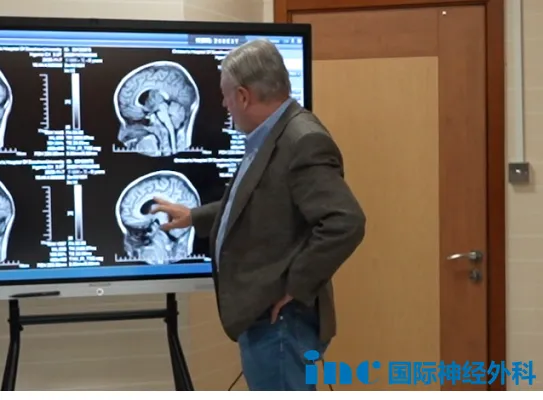 从10月11日意外查出，10月18日面对面咨询，到明日即将开启手术，1个月的时间，小航父母只想尽快为孩子解决问题。