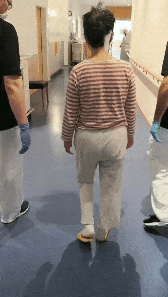 严女士术后第二天即可无人搀扶行走