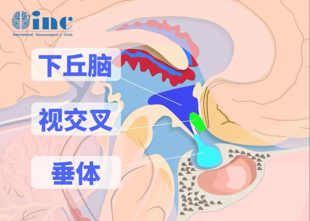 地方虽然不大，只有大约5.5平方厘米，却是众多关乎生命结构的汇集地——如颈动脉、基底动脉、海绵窦、垂体、下丘脑、视神经等多组颅神经等