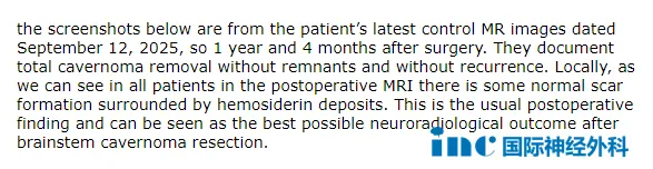 他意识清晰,肢体活动完全正常,听力也没有受到任何影响。 术前最担心的面瘫、失聪等风险,统统没有出现。曾经麻木无力的肢体,也在术后康复中慢慢焕发活力,生活逐渐回归正轨。