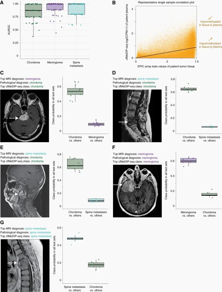 留一法模型基于血浆甲基化数据能准确将所有肿瘤分类至正确的聚类。