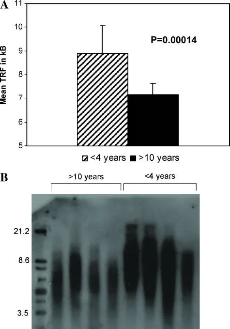 PLGG亚组患者端粒限制性片段(TRF)分析显示:4岁以下患儿(n=12)平均TRF长度显著大于10岁以上患儿(n=13),提示低龄患者端粒更长。