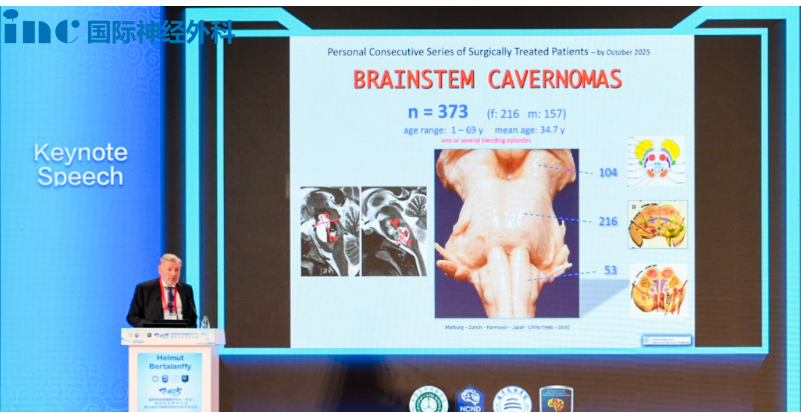 2025天坛脑网络神外年会——INC巴教授脑干海绵状血管瘤手术技术与策略优化