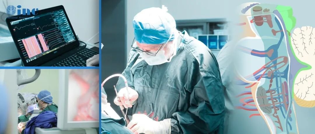 巴教授的操作变得更加细腻,他巧妙地从桥脑背侧一点点向前推进,最终安全地切除了腹侧的病灶。