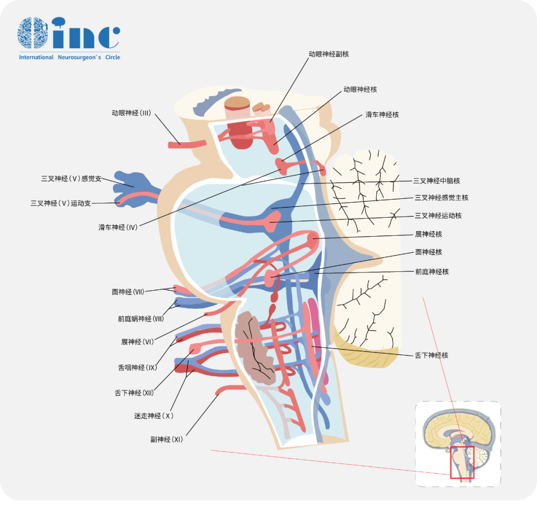 “手术禁区”——脑干为什么那么难?
