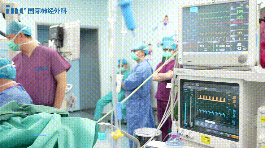 最终手术顺利，达到满意的切除，更未损伤孩子的神经功能