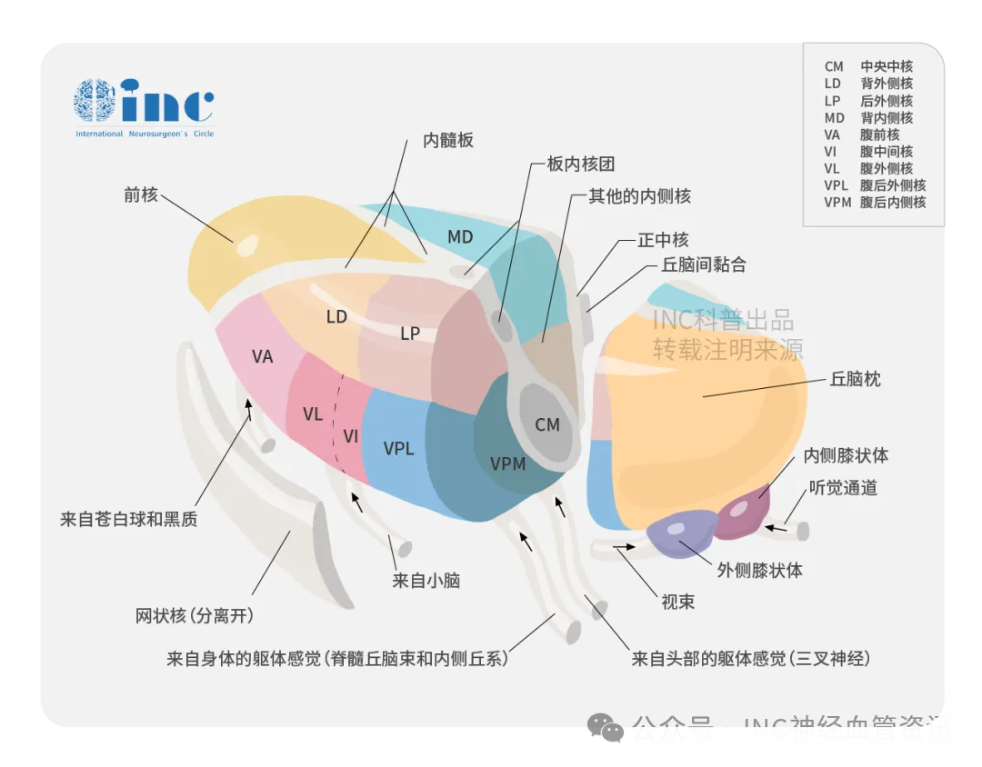 当眩晕呕吐不止，治疗却要赌上偏瘫风险？她该如何闯过丘脑海绵状血管瘤这一关？