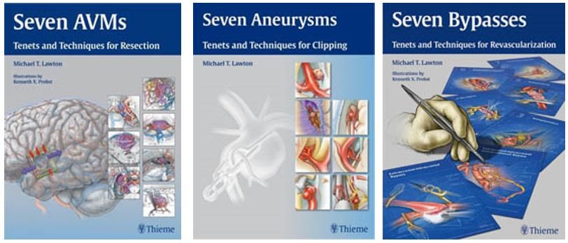 （动脉瘤手术治疗著作《七种脑动静脉畸形：切除原理和技巧》、《七种动脉瘤：夹闭术的原理和技巧》、《七种搭桥术：血运重建的原则和技术》）