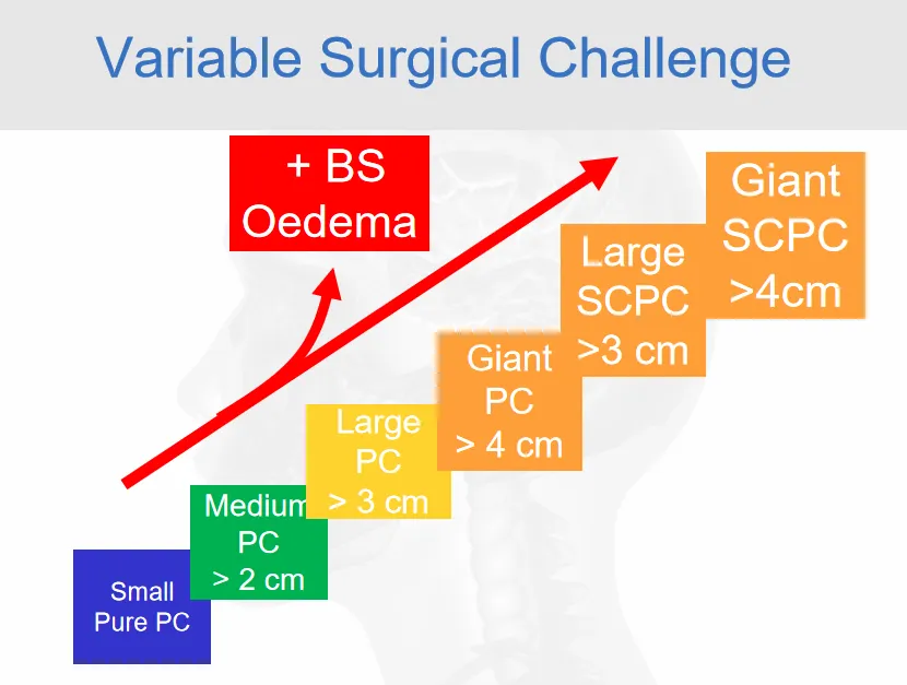 岩斜区这个位置的脑膜瘤，大小每增加1cm，手术难度就升级