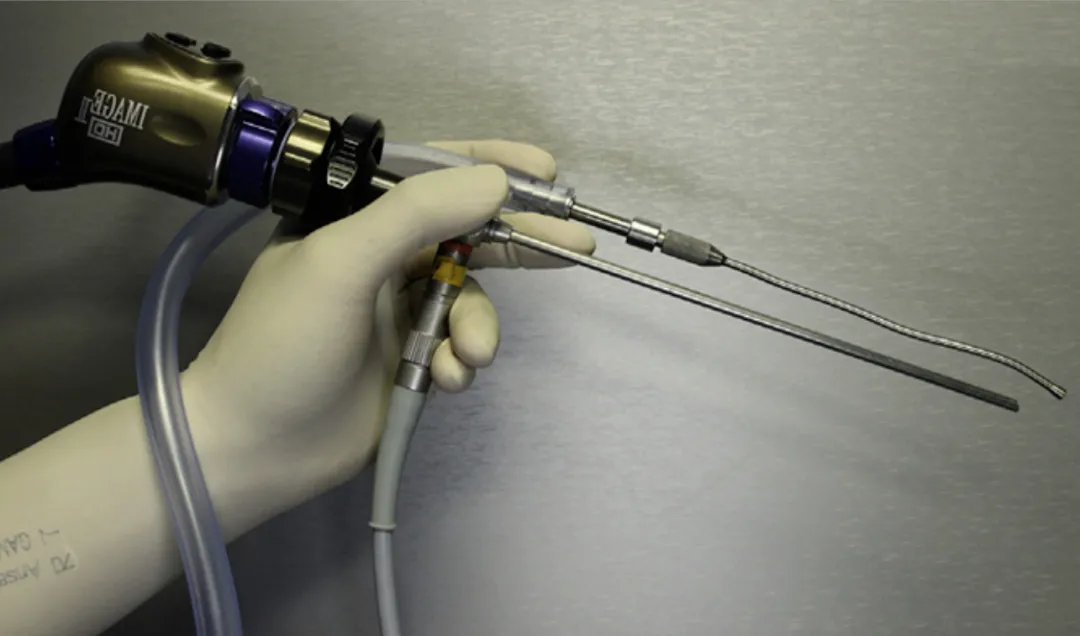 “筷子技术”神经内镜切除对侧肿瘤。