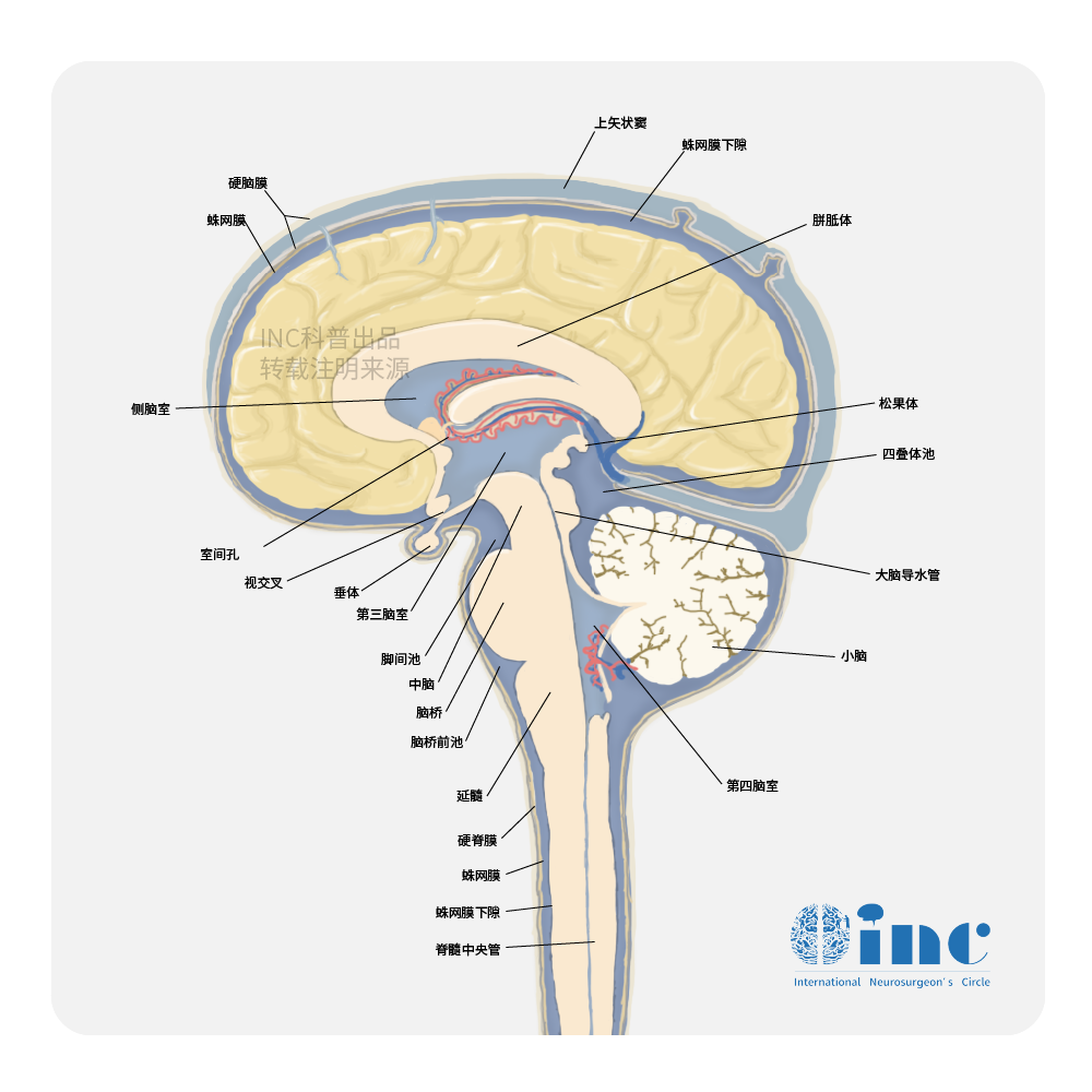 第三脑室肿瘤周围脑组织缺乏，肿瘤生长阻力较低，脑室内海绵状血管瘤生长速度较快，可形成巨型畸形。因此，由占位效应所引起的临床症状的发生几率更高。
