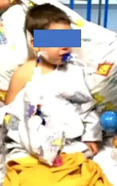 3岁幼童脑干出血险些病危,如今笑着烤出香软小面包!