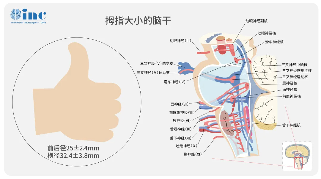 延髓-颈髓交界区,被称为神经外科的“手术禁区”,因其结构复杂、功能至关重要。