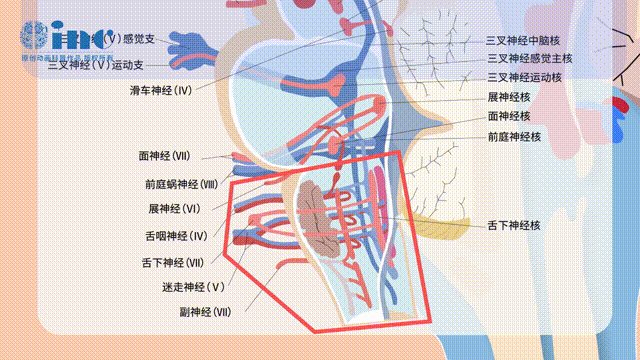 延髓这台手术有多难？