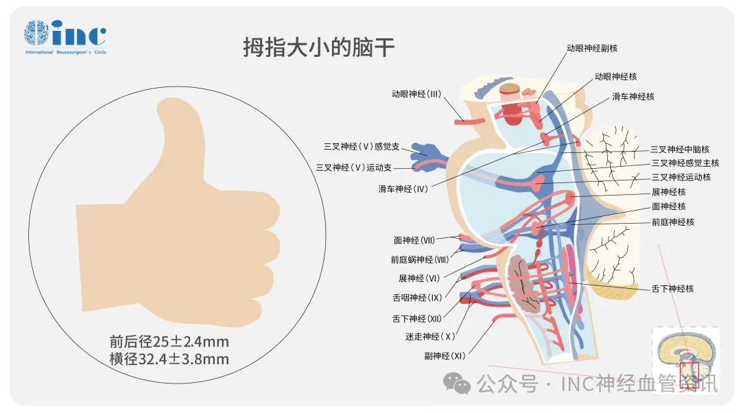 当脑干内的运动神经纤维受损，大脑发出的“运动指令”就无法顺利传达到身体对侧的肢体，从而表现为无力或瘫痪。
