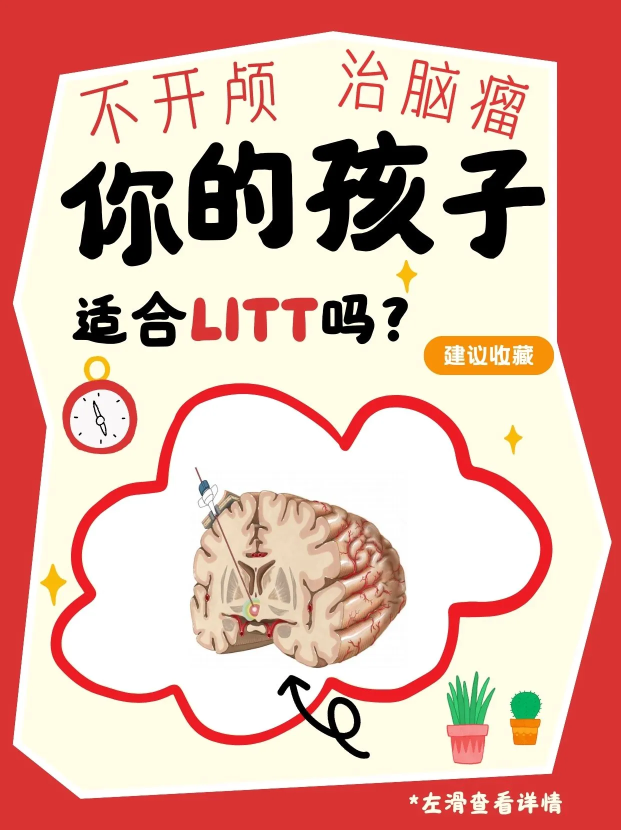 不开颅治脑瘤：你的孩子适合LITT技术吗？