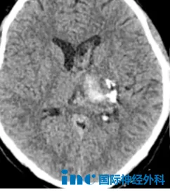 新患者咨询：在风险与收益间，做出理性抉择