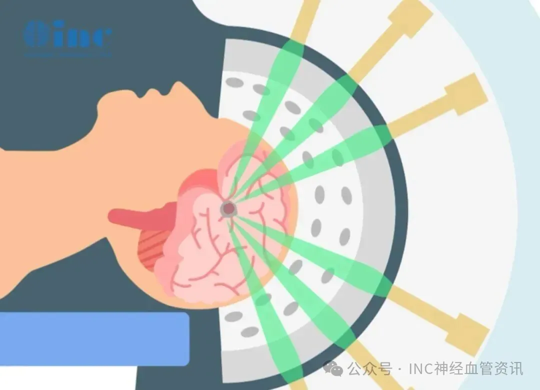 放疗是如何起作用的？