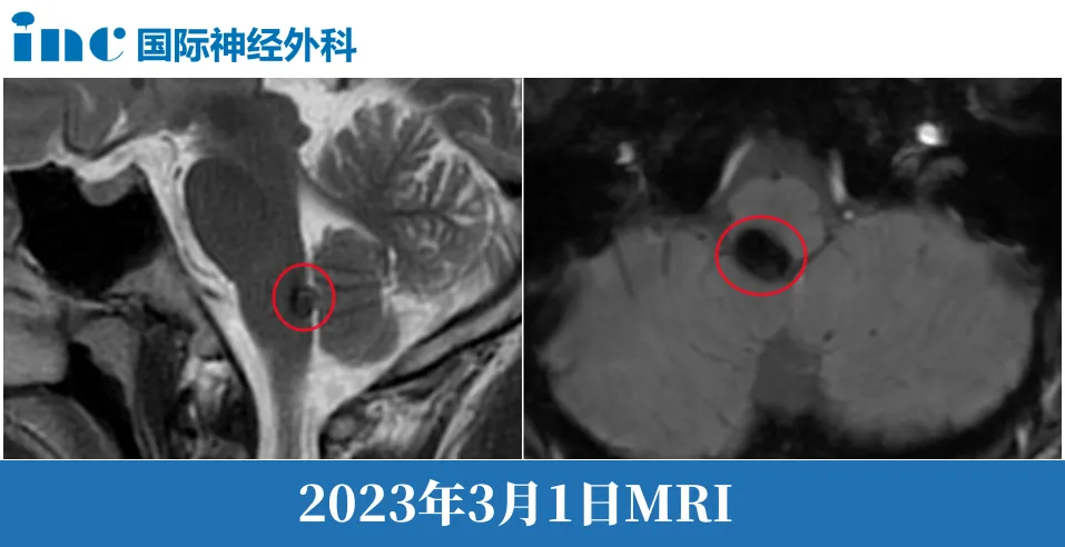 长在我大脑的最深处，是生命中枢