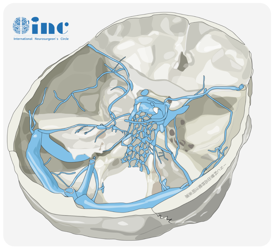 颅底重建（SBR）对预防持续性脑脊液漏相关并发症（脑膜炎、颅内积气等）至关重要