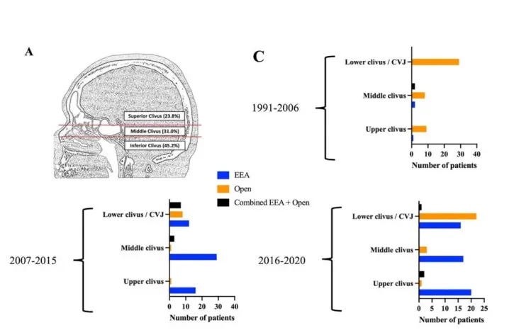 A:脊索瘤的分类根据其沿斜坡的矢状位置和病例的比例。上斜坡脊索瘤起源于鞍底以上，中斜坡脊索瘤起源于鞍底和蝶窦底之间，下斜坡脊索瘤起源于蝶窦底至颅颈交界区。C:图表显示了29年来三个时期(1991-2006年、2007-2015年和2016-2020年)手术入路的演变，并根据脊索瘤的位置。在最近两个时期，内镜经鼻入路是最常用于上、中斜坡脊索瘤。