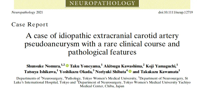 58 岁男子仅因一次打喷嚏，就触发了特发性颅外颈动脉假性动脉瘤破裂