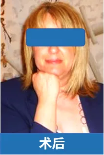 上述真实案例及图片来自于INC巴特朗菲教授课程演讲。