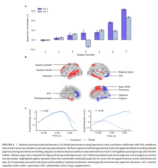 成功和不良瞳孔反应预测示例如图4C所示。正Spearman等级相关系数代表成功预测,而零或负相关系数代表不良预测性能。