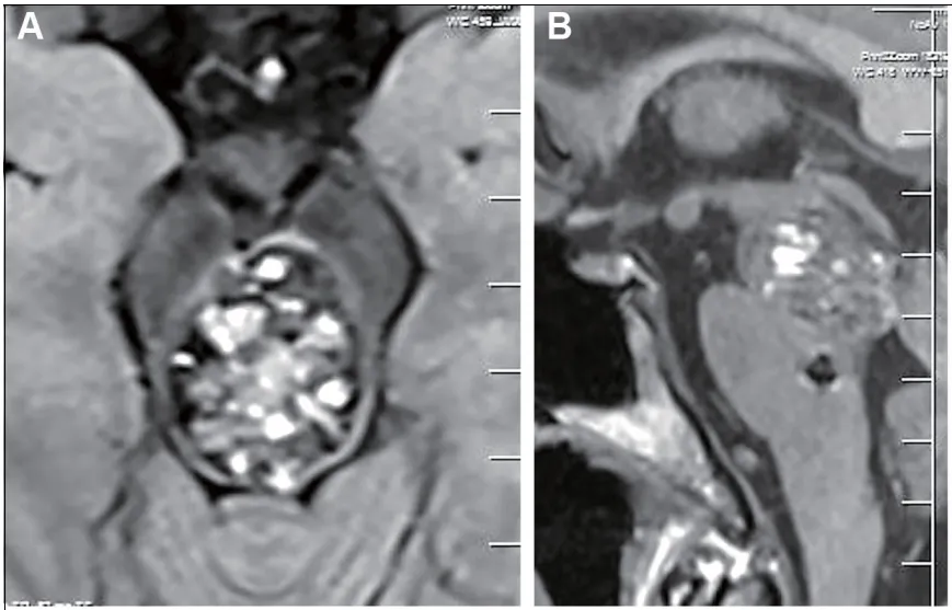 术前:轴位和矢状位增强磁共振成像