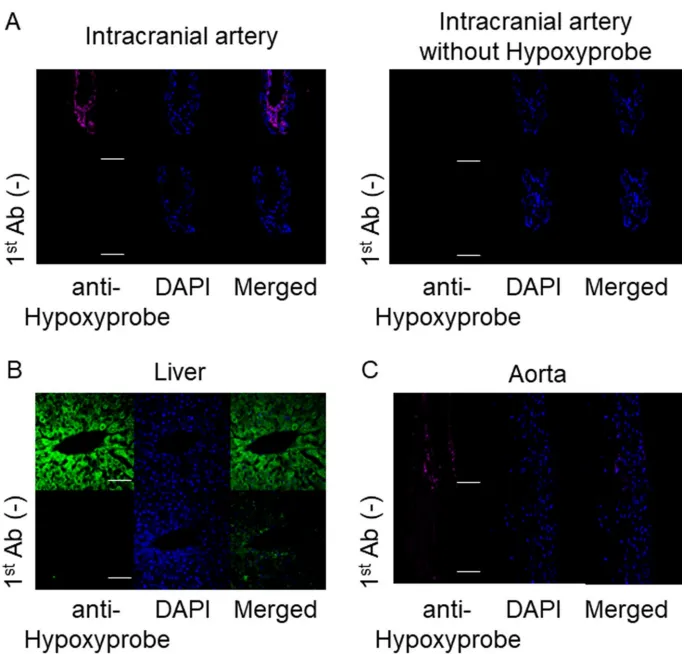 Hypoxyprobe检测显示，颅内动脉外膜细胞呈缺氧阳性（图A），肝脏中央静脉周围细胞作为阳性对照（图B），而主动脉仅见稀疏信号（图C），证实颅内动脉外膜缺氧的独特性。