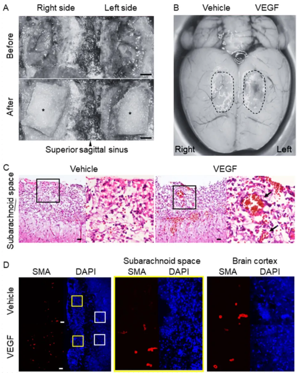 为确认VEGF的直接作用，研究人员在大鼠脑表面放置VEGF缓释片。结果发现，仅需6天，VEGF处理侧就出现了明显的血管新生，而对照侧则无此现象。