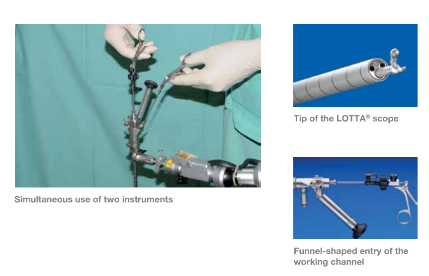 施罗德教授LOTTA脑室镜