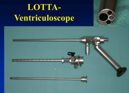 兼具高精度与微创性的脑室镜系统，被用于脑室内病变的微创诊疗