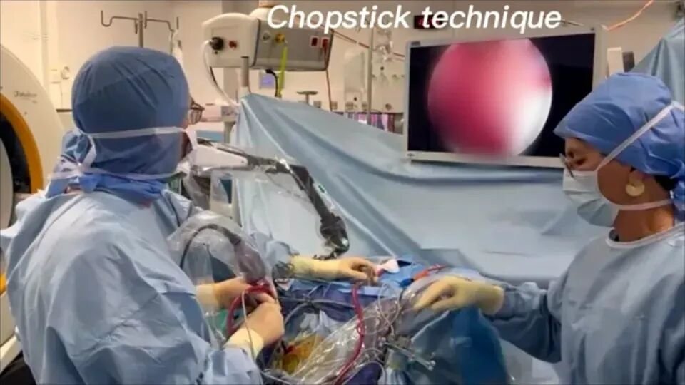 人镜合一的“筷子技术”是什么？