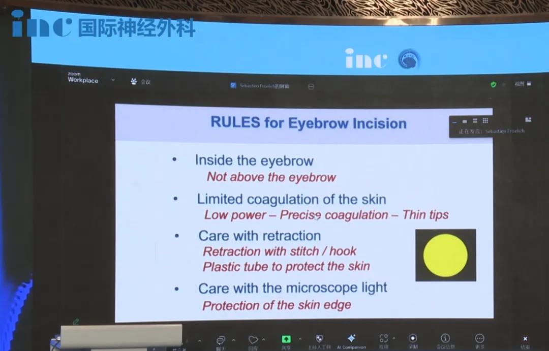 手术需遵循以下核心操作规则，旨在实现微创、美观及保护组织