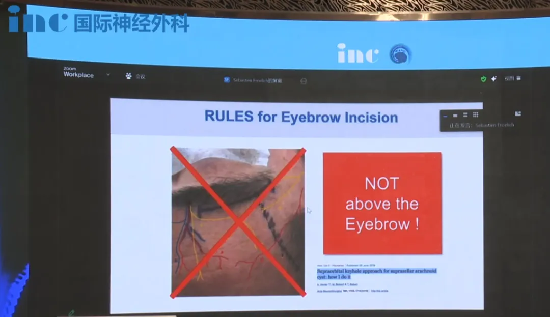 1. 切口位置选择