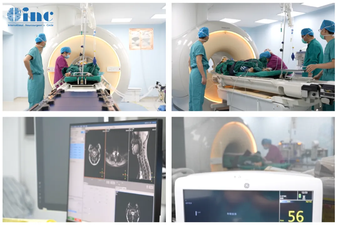 INC国际教授示范手术中，术中核磁运用