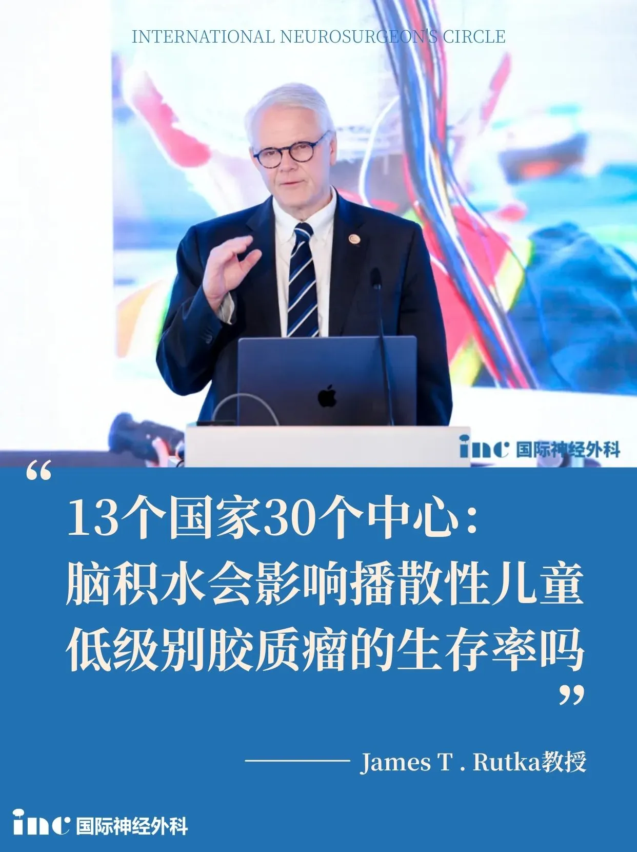 脑积水会影响低级别胶质瘤患儿的生存率吗？