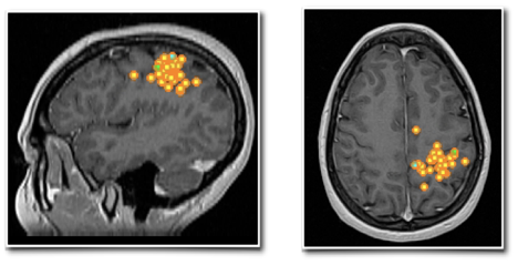 左图为矢状位视图，右图为轴位视图